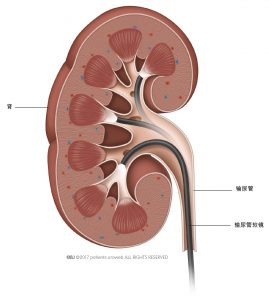 图 2: 软性输尿管镜基本上可让医生到达肾内任何位置。