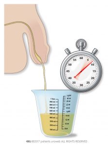 图2：在家里测量尿流率。
