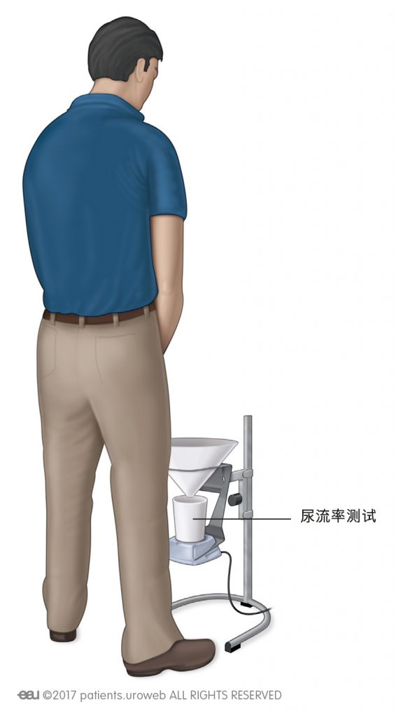图 1: 适用于男性和女性的普通型尿流率测试容器。