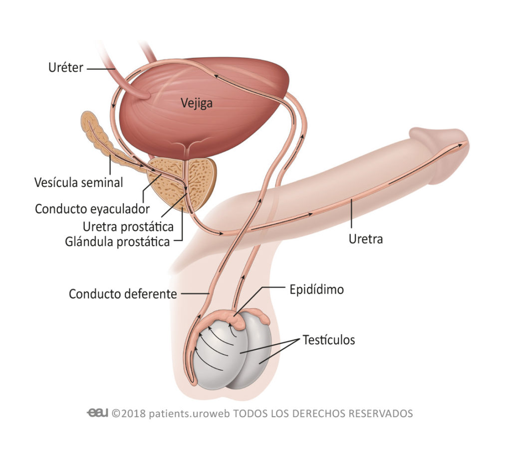 síntomas de cáncer de próstata etapa 1