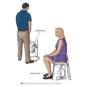 Slika 1: Uobičajeni tip spremnika za uroflowmetriju za muškarce i žene