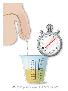 Fig. 2: Medir o fluxo urinário em casa.