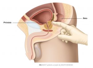 Fig. 1. Toque retal para sentir o tamanho, a forma e consistência da próstata.