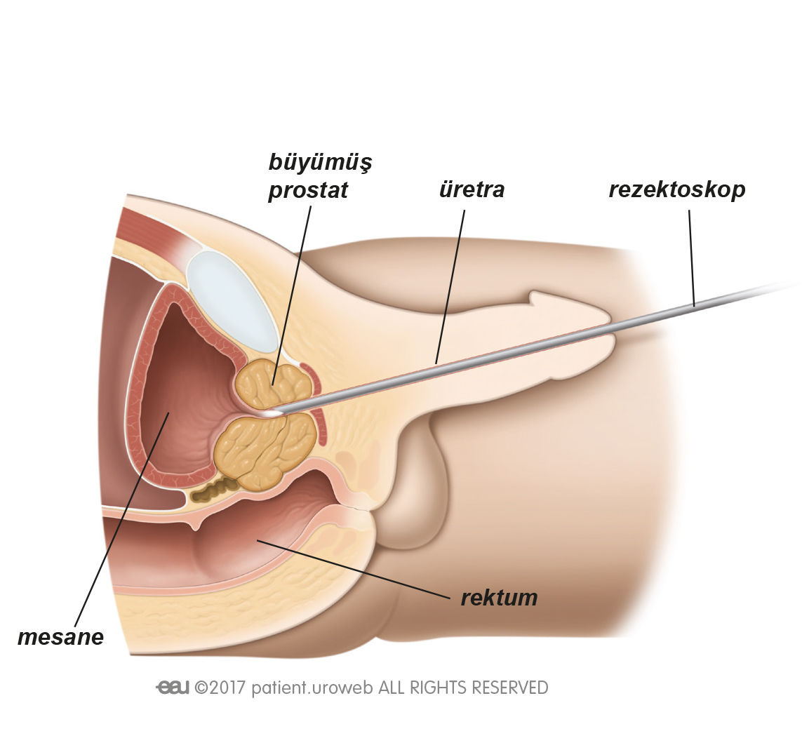 Sybian Prostate