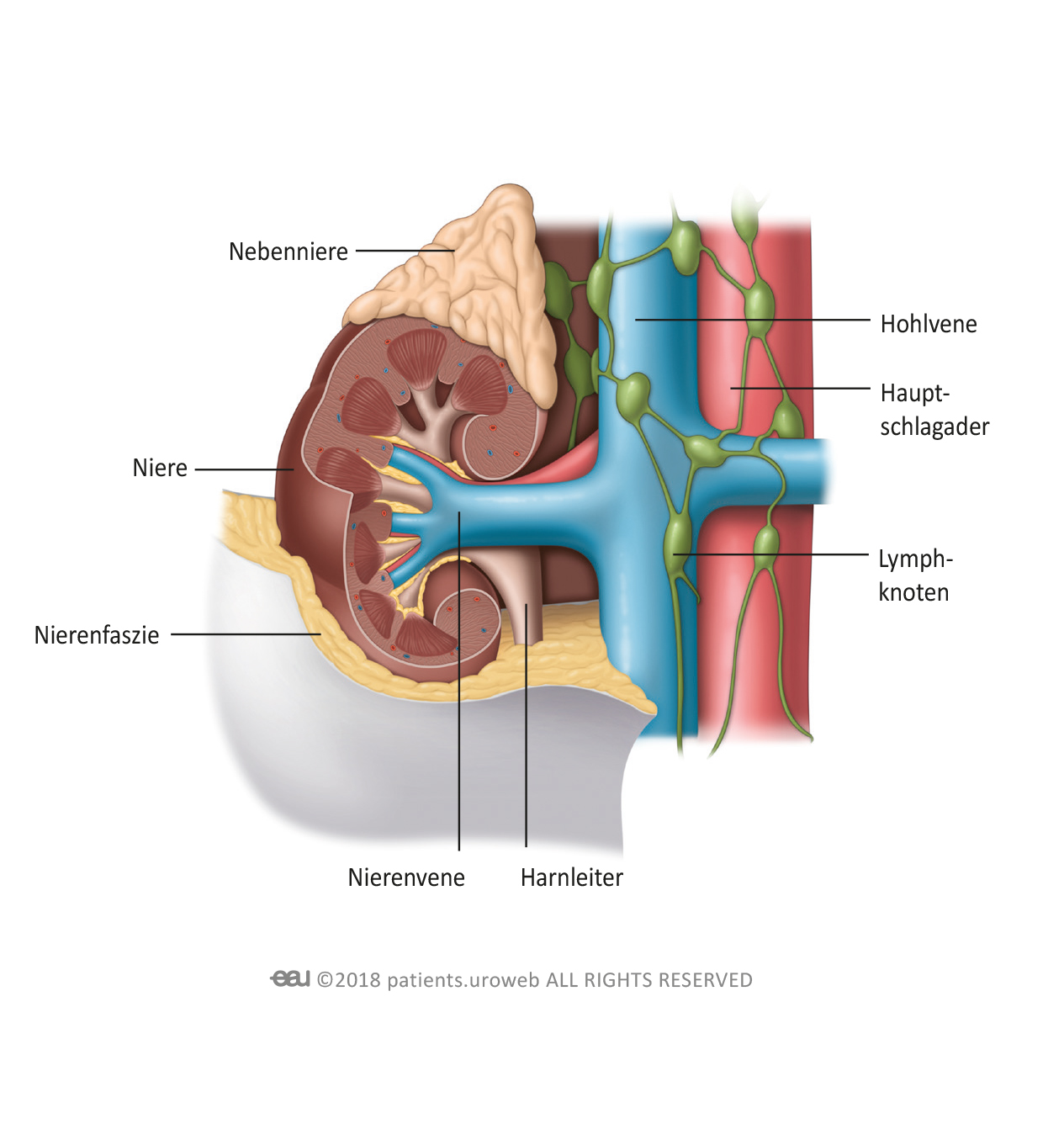 Can Kidney Cancer Return After Nephrectomy