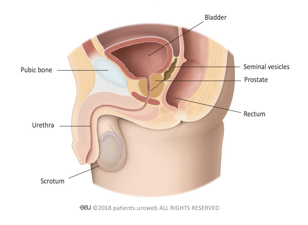 Papillary lesion in prostatic urethra - comunicaliber.ro Papillary lesion prostate