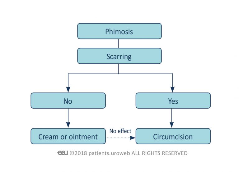 What Is Meaning Of Phimosis