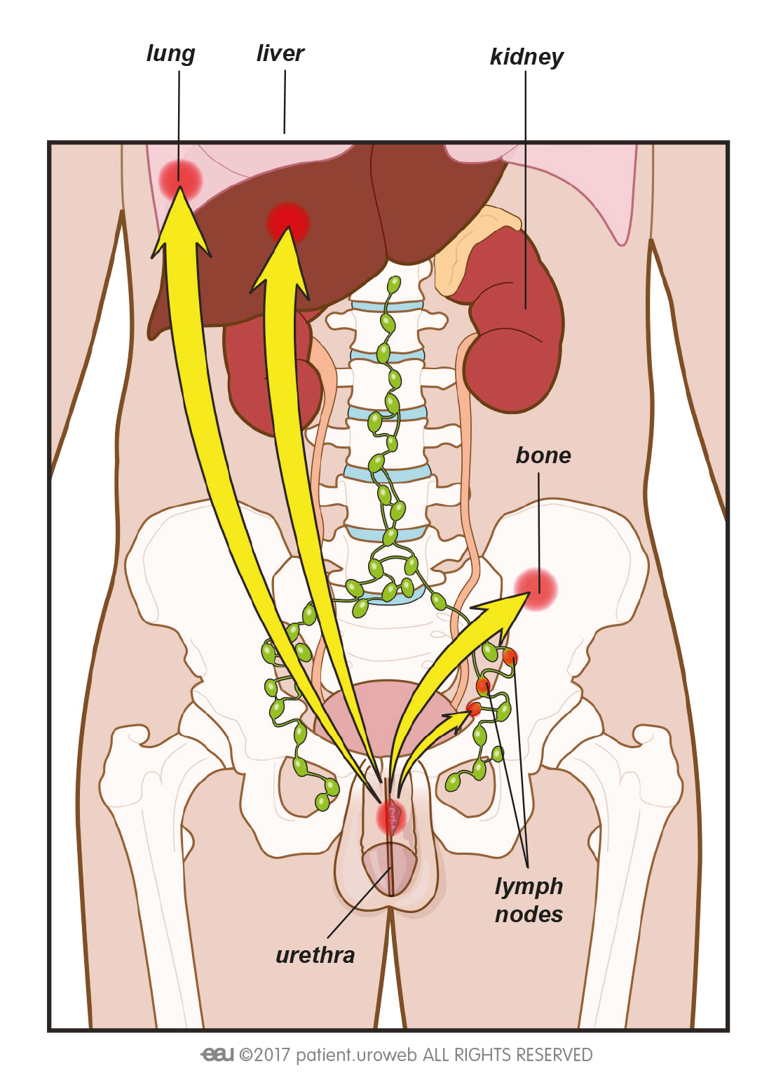 Testicular Cancer Patient Information