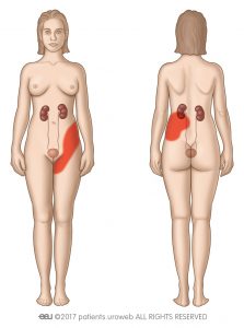 Fig. 2: Area of possible renal colic pain.