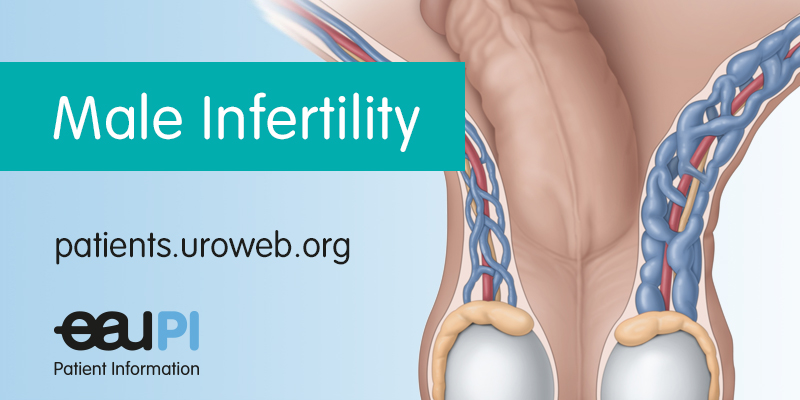 Male infertility - Patient Information